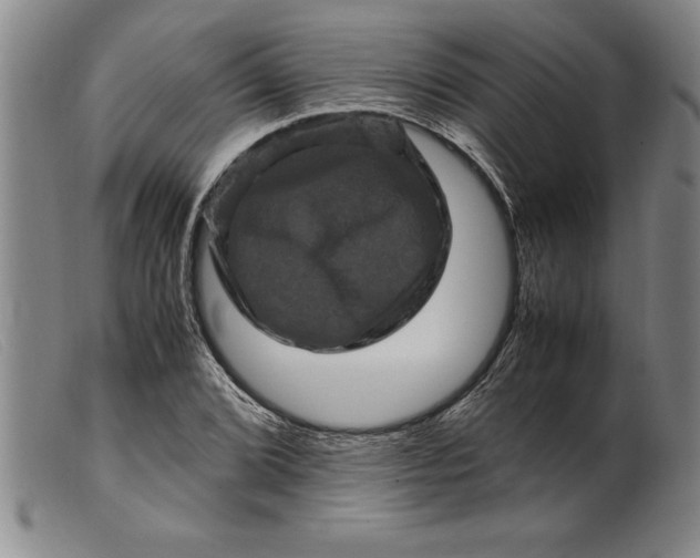 X0000099471072200805231825