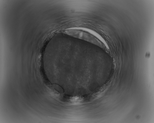 X0000099470319200805301602