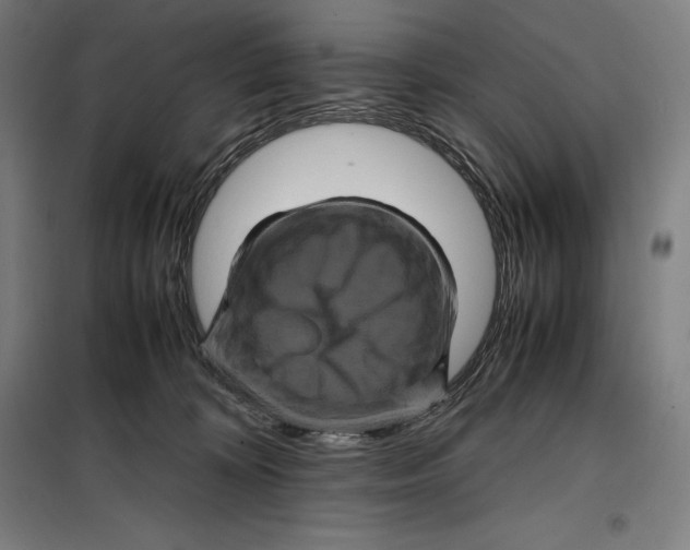 X0000099470324200805301602