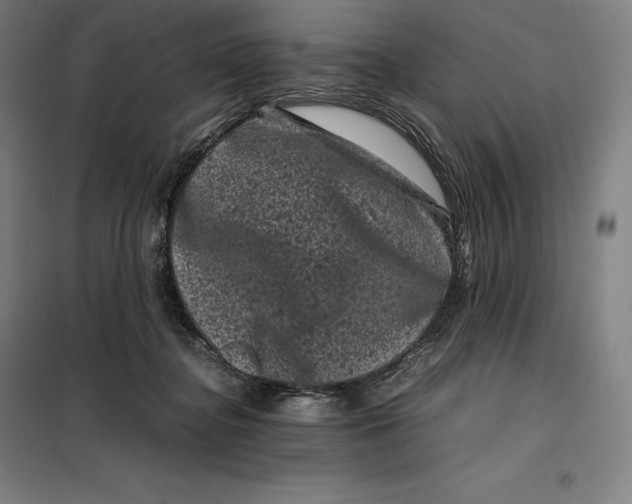 X0000099470364200805301601