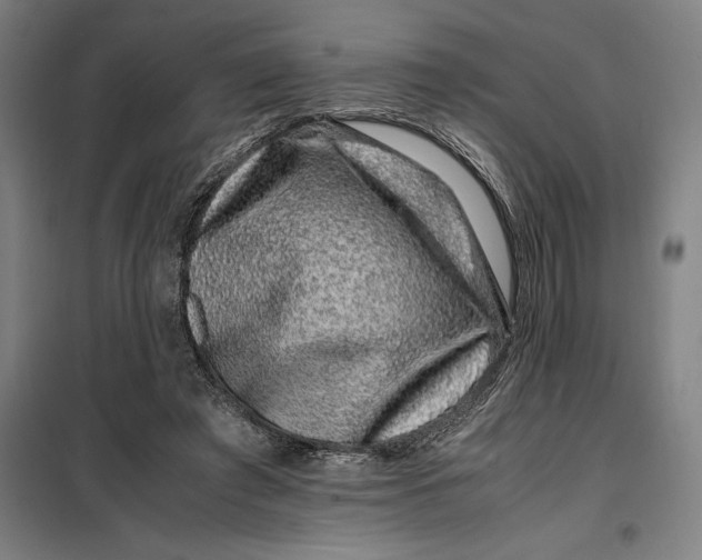 X0000099470401200805301601