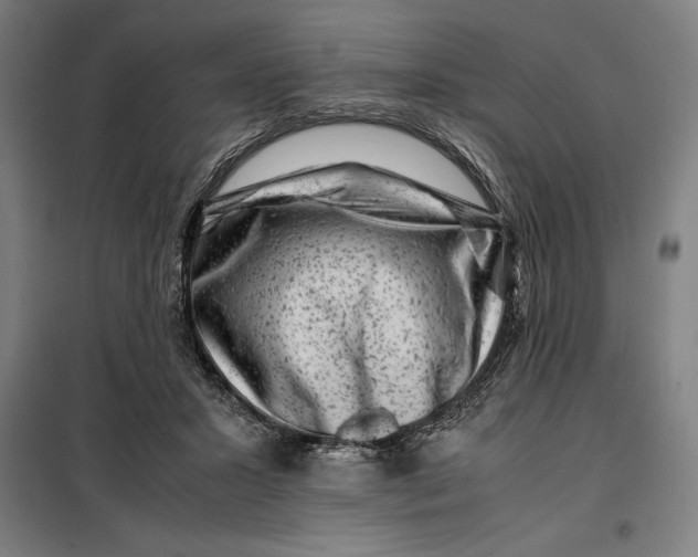 X0000099470407200805301601