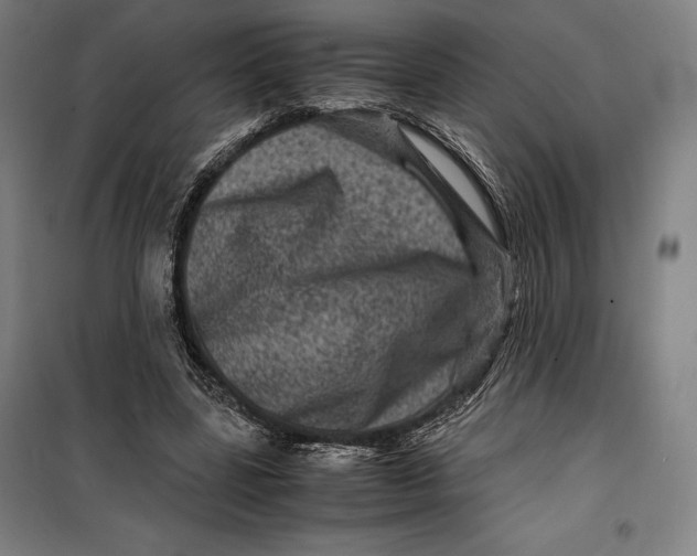 X0000099470539200805301558