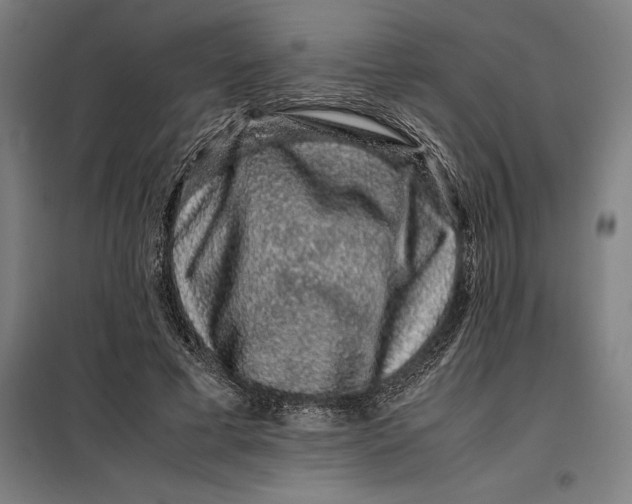 X0000099470593200805301558