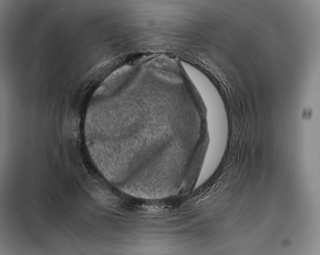 X0000099470693200805301556