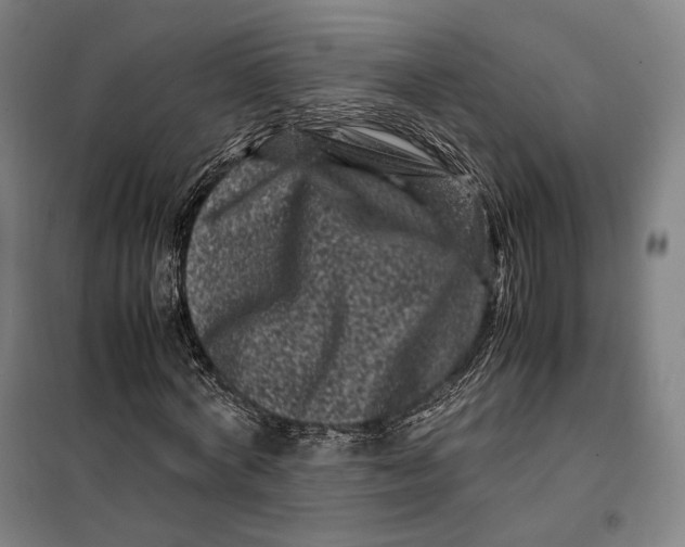 X0000099470772200805301555