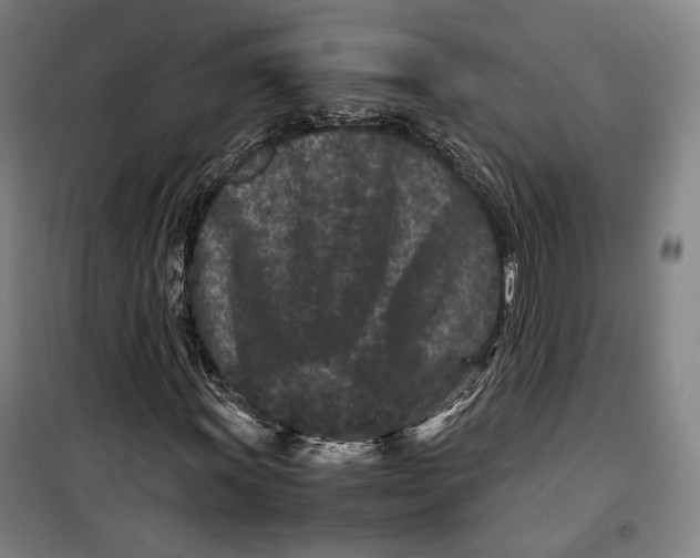 X0000099471011200805301551