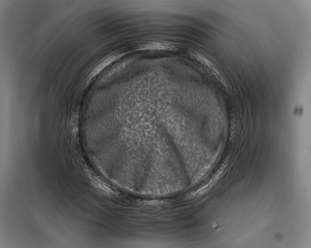 X0000099471017200805301551