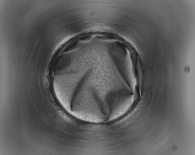 X0000099471018200805301551