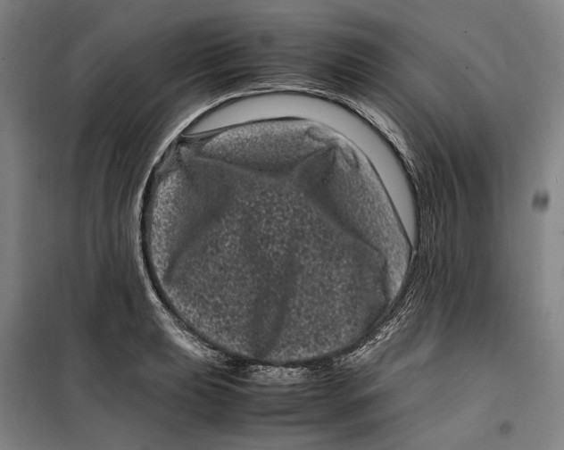 X0000099471039200805301552