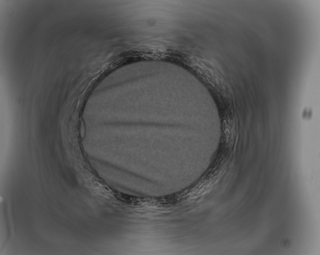 X0000099471057200805301551