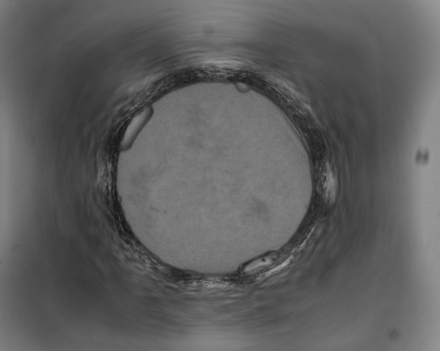 X0000099471061200805301551