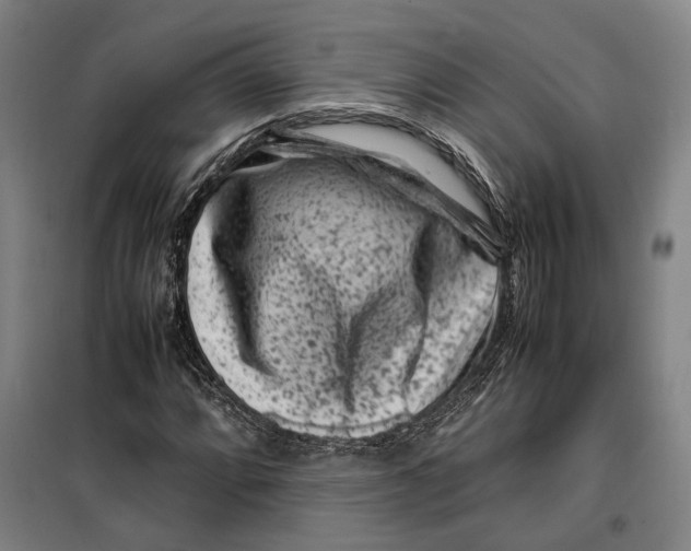 X0000099471064200805301551