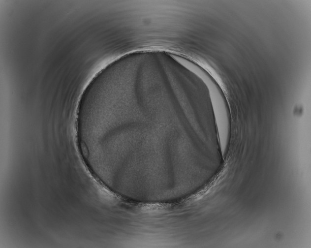 X0000099471093200805301551