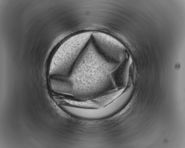 X0000099471122200805301550