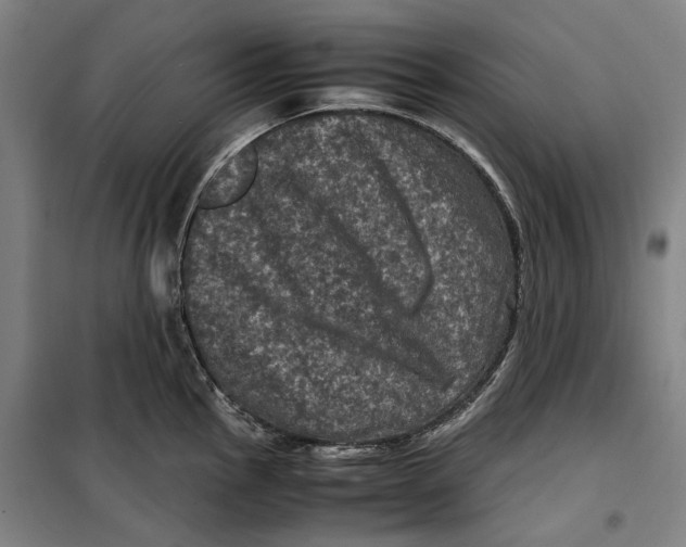 X0000099471145200805301550