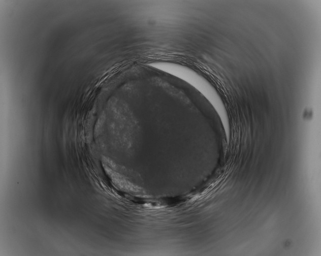 X0000099471154200805301550