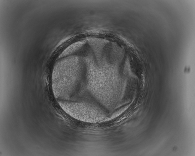 X0000099471206200805301548