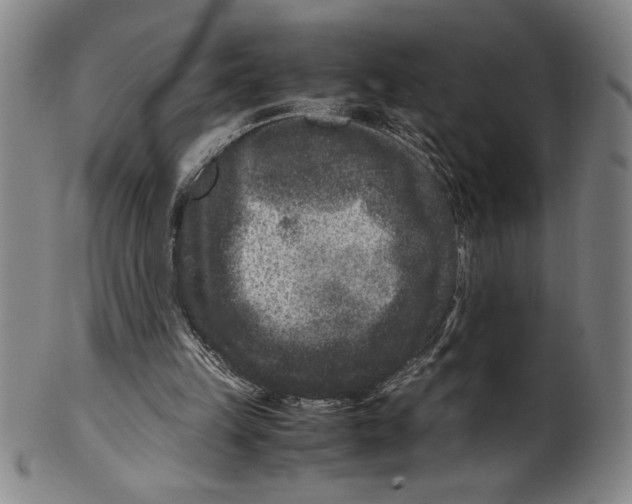 X0000099470149200806061228