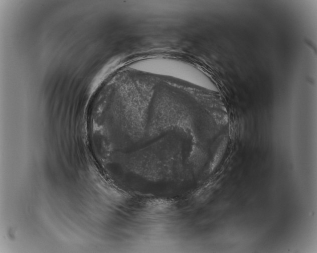 X0000099470198200806061228