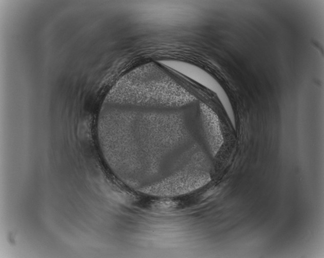 X0000099470217200806061228