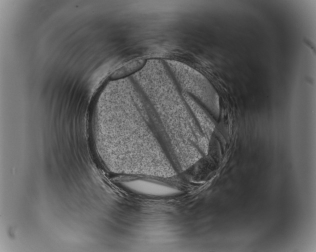 X0000099470244200806061226