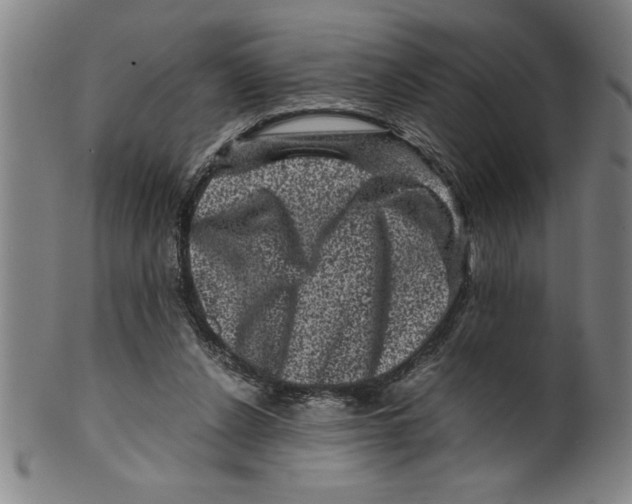 X0000099470256200806061227