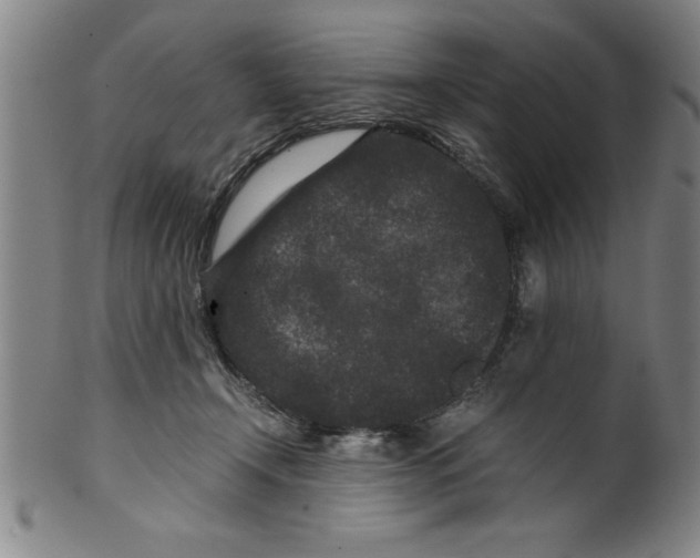 X0000099470366200806061225