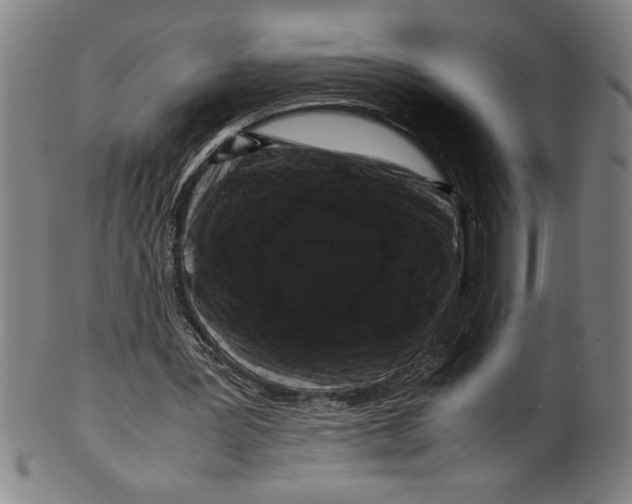 X0000099470387200806061225