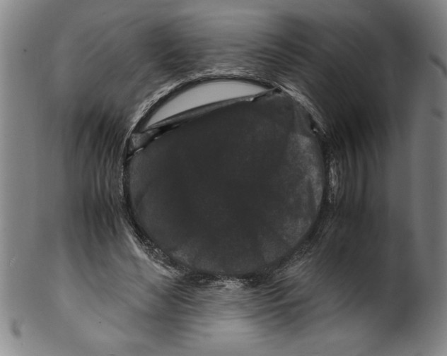 X0000099470492200806061223