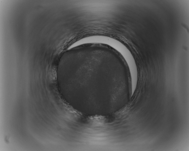 X0000099470517200806061223