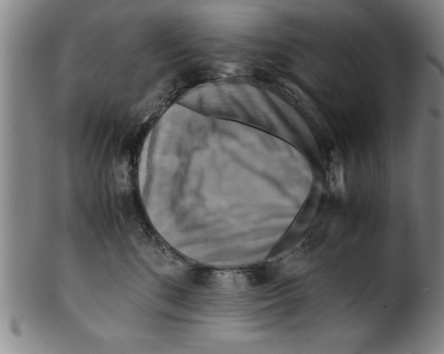 X0000099470520200806061223