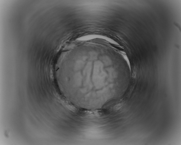 X0000099470524200806061223