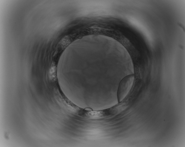 X0000099470526200806061223