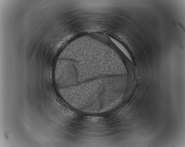 X0000099470539200806061222