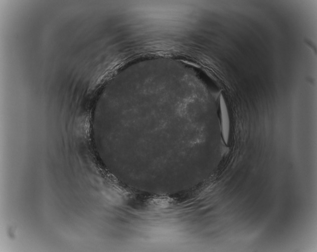 X0000099470595200806061222