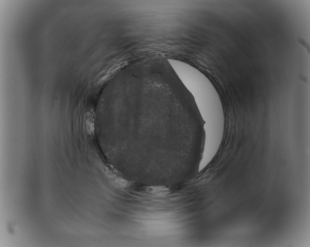 X0000099470719200806061220