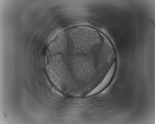 X0000099471001200806061215