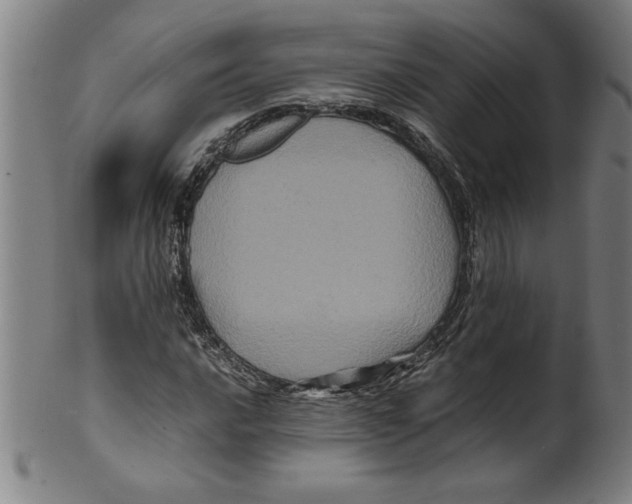 X0000099471016200806061214