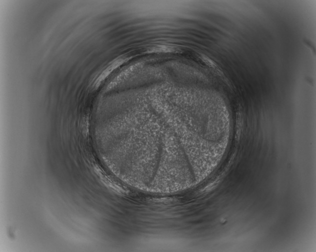 X0000099471017200806061214