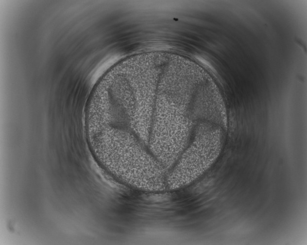 X0000099471047200806061215