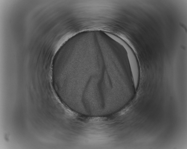 X0000099471093200806061214