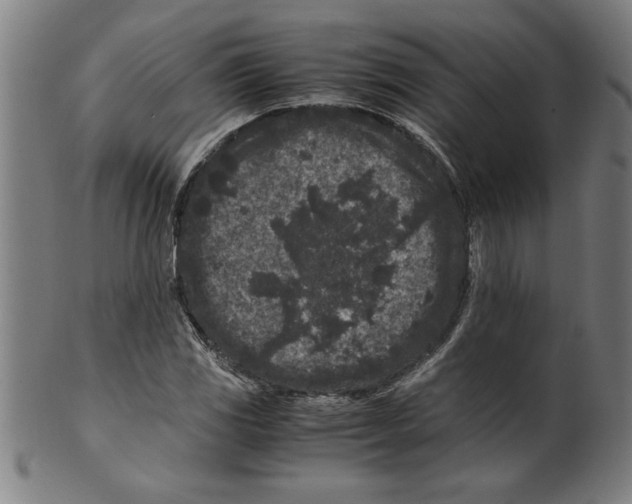 X0000099471117200806061213