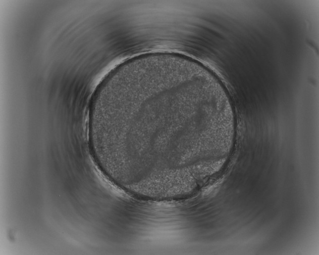 X0000099471126200806061213