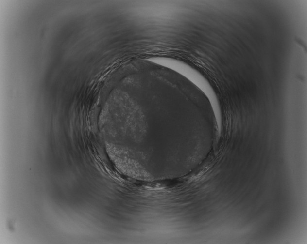 X0000099471154200806061213