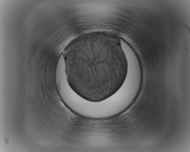 X0000099471185200806061212