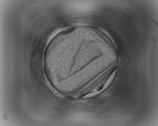 X0000099471195200806061212