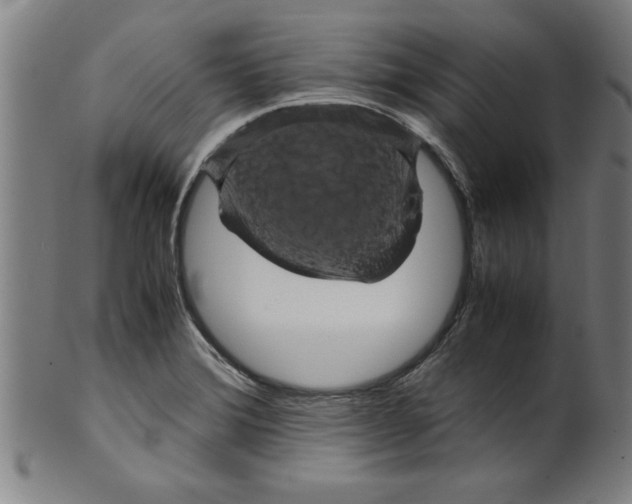 X0000099471372200806061210