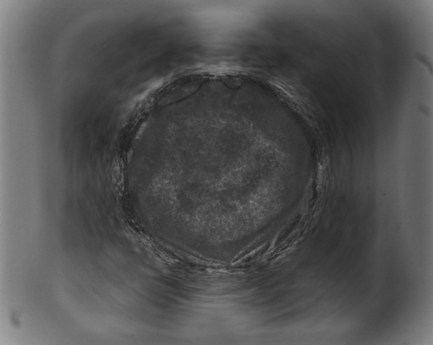 X0000099471398200806061209