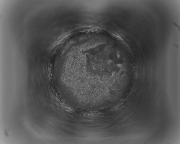 X0000099471399200806061209